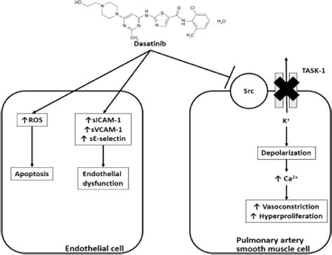 rbreezyscandal|Sprycel (dasatinib) and risk of pulmonary arterial hypertension.